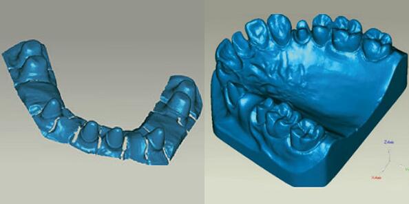 上海抄數(shù)服務公司提供的口腔抄數(shù)服務